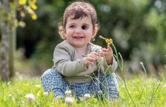 technology : Toddler who had eye removed due to rare cancer gets new prosthetic design