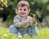 technology : Toddler who had eye removed due to rare cancer gets new prosthetic design